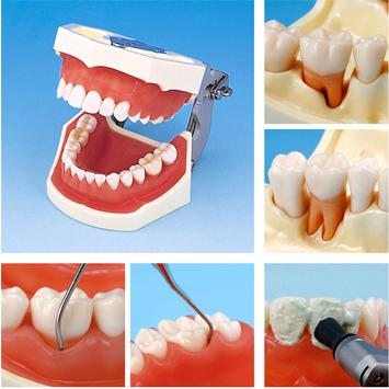 ��ǻר��ѵ��ģ��