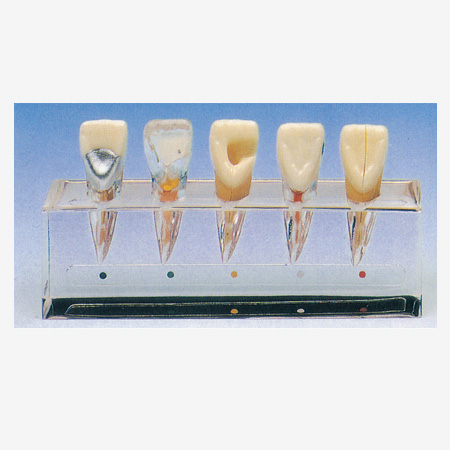 ���ݲ���ϵ��ģ��