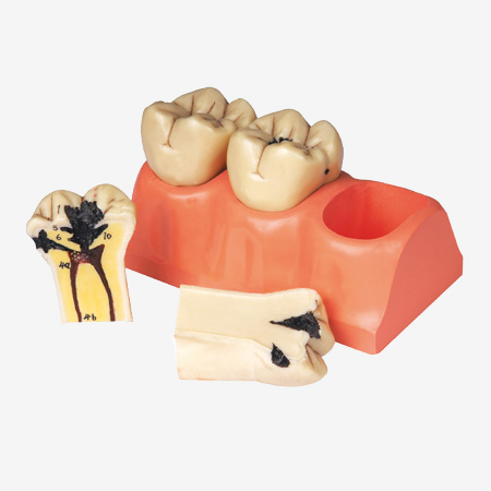 ȣ�ݷֽ�ģ��