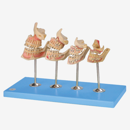 �����ǵķ���ģ��