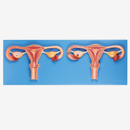 �����ܾ����̷Ŵ�ģ��